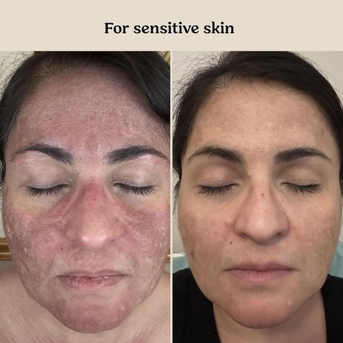 Roe Wellness Baby Cream & Serum Power Pair - Hydrating Skincare for All Ages | For Dry, Irritated Skin