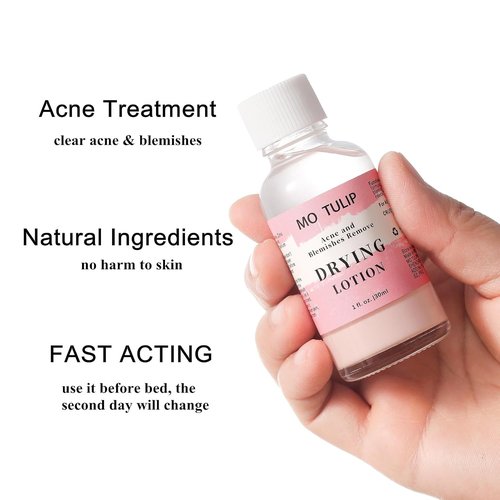 MO TULIP Acne Drying Lotion - Overnight Spot Treatment for Face & Body, 1oz Pimple & Blemish Solution