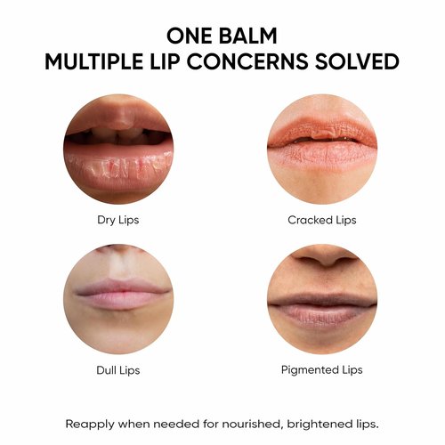 Masofta Shea Butter Lip Balm - Smooth & Clear Lips with Kojic Acid & SPF 30 | 0.52 oz (15g)