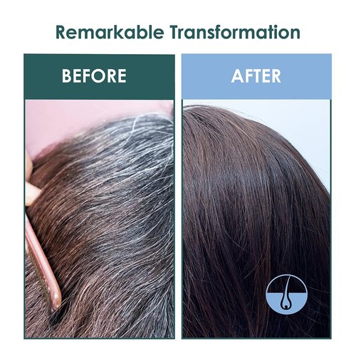 SH-RD Intensive Scalp Essence - Anti-Aging Hair Growth Serum with Amino Acids & Vitamin B5 | 50ml/1.69oz