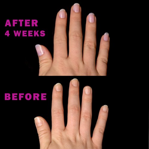 Perfect Formula Nail Essentials Kit – 4-Piece Keratin Nail Strengthener and Growth - Nail Repair For Damaged Nails | High Gloss Finish, Nail Polish and Treatment for Longer, Stronger Nails