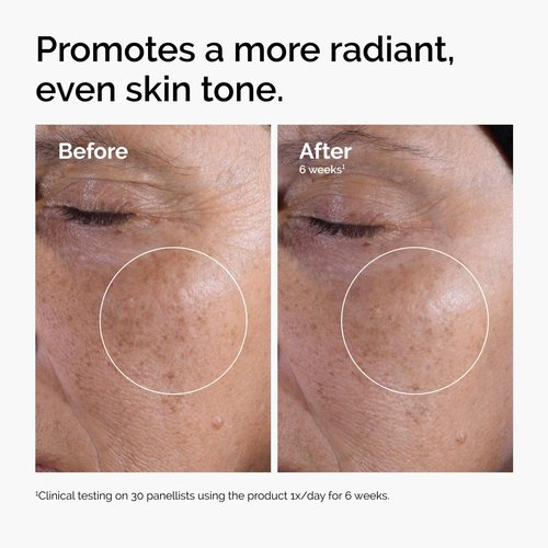The Ordinary Glycolic Acid 7% Exfoliating Toner - Brightening & Smoothing Daily Toner for Even Skin Tone