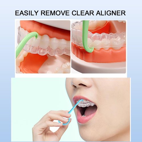 Maoerdental 20PCS Aligner Remover Tool,5 Colors Clear Aligner Removal Tool for Invisalign Removable Retainers, Aligners,Braces Removal Kit
