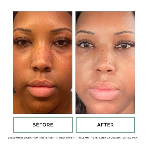 Replenix Vitamin C Pro Collagen Serum - Brightening Anti-Aging Treatment with Medical-Grade Antioxidants
