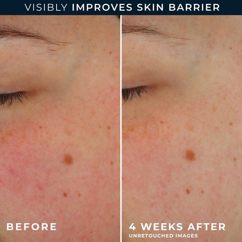 RoC Barrier Renew Day Cream with SPF 30, Moisturizer with Ceramides & Prebiotics to Protect Skin Barrier, (2.5 oz) with Retinol Eye Cream Packette