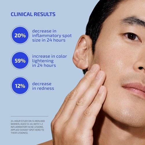 Codex Labs Shaant Spot Hero – 5% Sulfur Acne Spot Treatment | Clinically Tested for Sensitive Skin | 0.5 oz