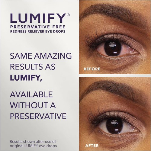 LUMIFY Eye Drops - Preservative-Free Redness Reliever for Sensitive Eyes | 20 Single-Use Vials, Works in 1 Minute