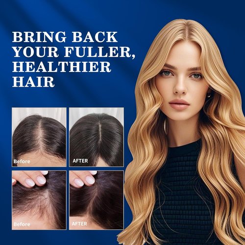 Regine Switzerland Minoxidil Hair Growth Spray Kit - Extra Strength Treatment for Thinning Hair & Beard - 2PCS