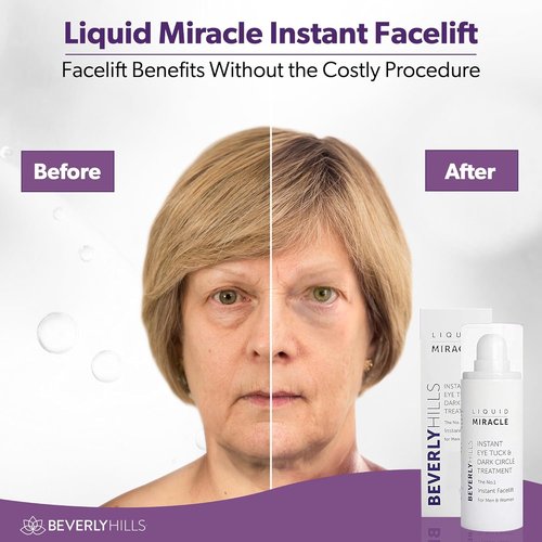 Beverly Hills Instant Facelift Eye Serum - Anti-Aging Treatment for Dark Circles & Puffiness | 30mL (120 Days Supply)
