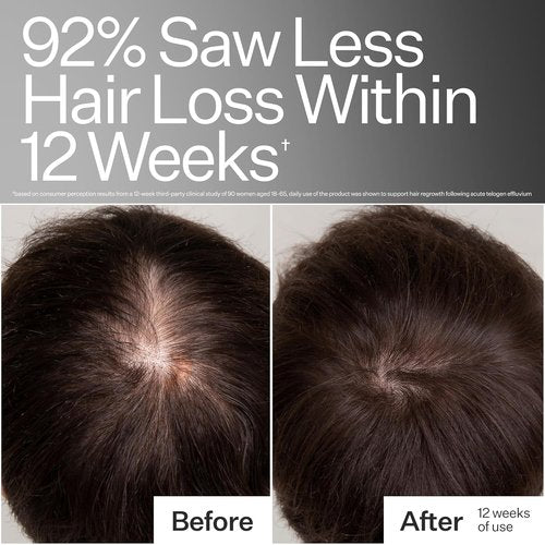 Act+ Acre Cold Processed Stem Cell Peptide Treatment - Boost Hair Density with Grape Stem Cells & Peptides | 3 Fl Oz