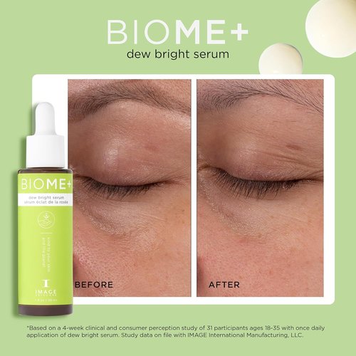 IMAGE Skincare Biome+ Dew Bright Serum - Microbiome Friendly Facial Serum for Enhanced Luminosity & Elasticity
