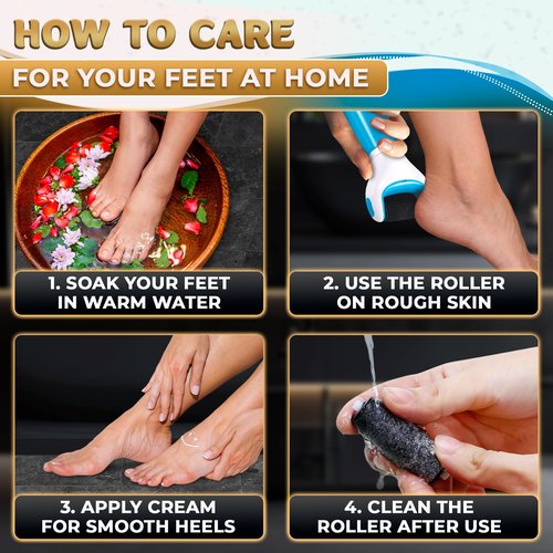 11 Pcs Replacement Rollers for Electric Foot Callus Remover Tool - 7 Extra Coarse & 4 Regular Coarse Refill Heads (1.92 x 0.65 Inches), Micro-Diamond Crystals - Compatible with Amope Pedi Perfect Pro