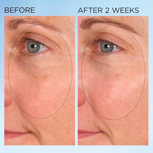 **Elizabeth Arden Dark Spot Corrector - Vitamin C Serum Capsules for Radiant Skin & Even Tone**
