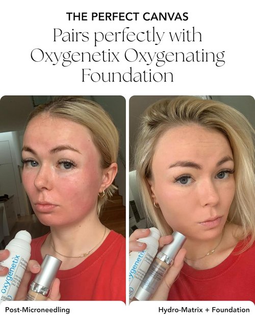 Oxygenetix Oxygenating Hydro-Matrix | Lightweight Aloe-Based Face Moisturizer with Hyaluronic Acid (2.54oz) for Sensitive Skin