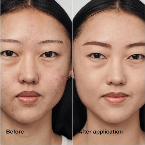 Clinique Even Better Clinical Serum Foundation - Full Coverage Hydrating SPF 25 with Vitamin C & Hyaluronic Acid for Oily Skin