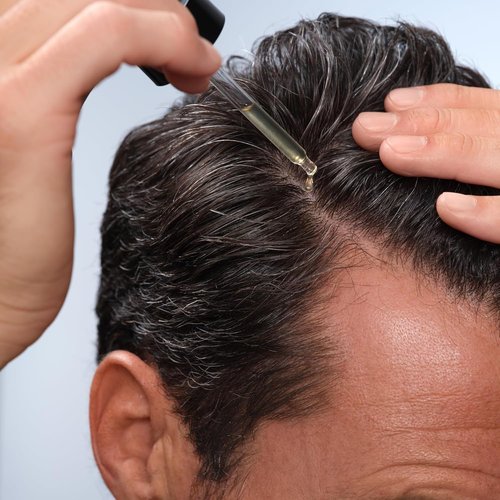 Caldera + Lab Hair Serum - Men’s Thickening Serum for Thinning Hair, Supports Fuller & Stronger-Looking Hair, Dermatologically Tested