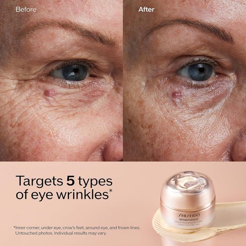 Shiseido Eye Care Set - Smooth & Hydrate with Cleansing Foam, Serum, Wrinkle Cream & Eye Cream - $145 Value