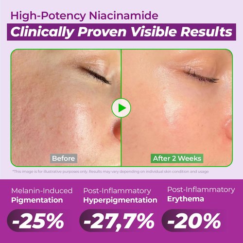 JUMISO Niacinamide 20% Face Serum, Dark Spot & Uneven Tone Care, TXA + Glutathione, Pore & Oil Control for Glass Skin, Centella Soothing, Korean Skincare, 40ml (1.35 fl oz)