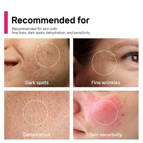 Arbutin 7% + Tranexamic Acid 5% + Niacinamide 2% Intensive Tone Care Facial Cream -Dark Spots, Freckle, Blemishes, Pigmentation, Dull & Uneven-Looking Tone w/ Alpha Arbuitn 20,000 ppm Korean Skincare