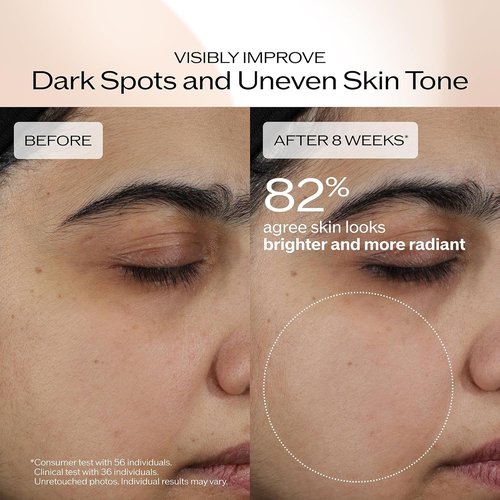Shiseido Benefiance Brightening Cream - Plant-Based Retinol Moisturizer for Dark Spots & Wrinkles - 24HR Hydration