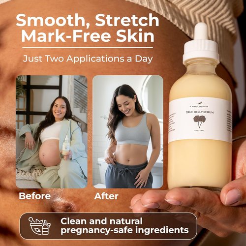 8 Sheep True Belly Serum - Pregnancy-Safe Hydrating Belly Oil with Hyaluronic Acid & Centella Asiatica | 4 FL OZ