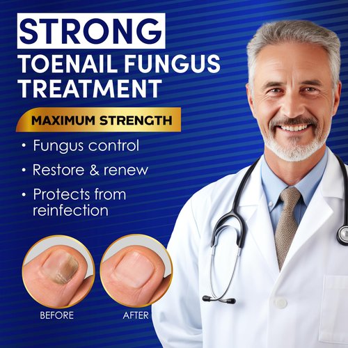 Toenail Fungus Treatment Extra Strength – VTROUY 2 Bottle Nail & Toe Solution with Undecylenic Acid 25% and Tea Tree Oil 15ml 2Pcs