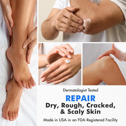 Ebanel Urea Cream 40% with Salicylic Acid - Intensive Foot Cream for Dry Cracked Skin | 4 Oz