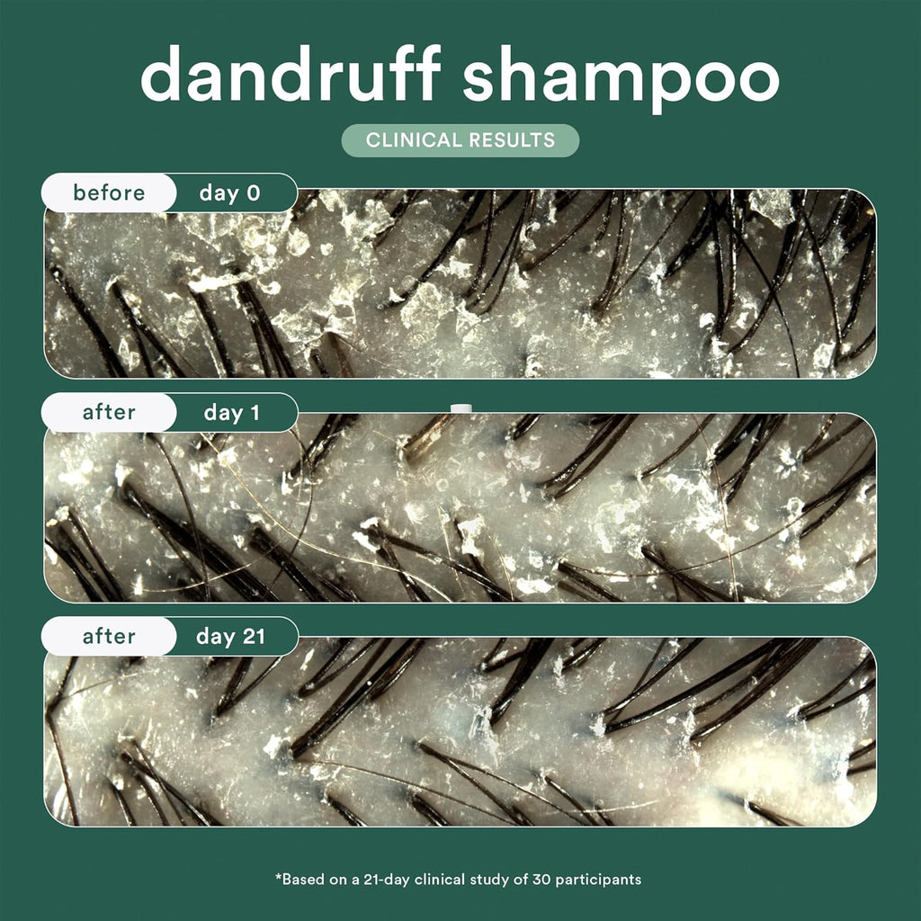 VERB® Dandruff Shampoo - Clinical Strength Relief with 3% Salicylic Acid for Gentle Cleansing