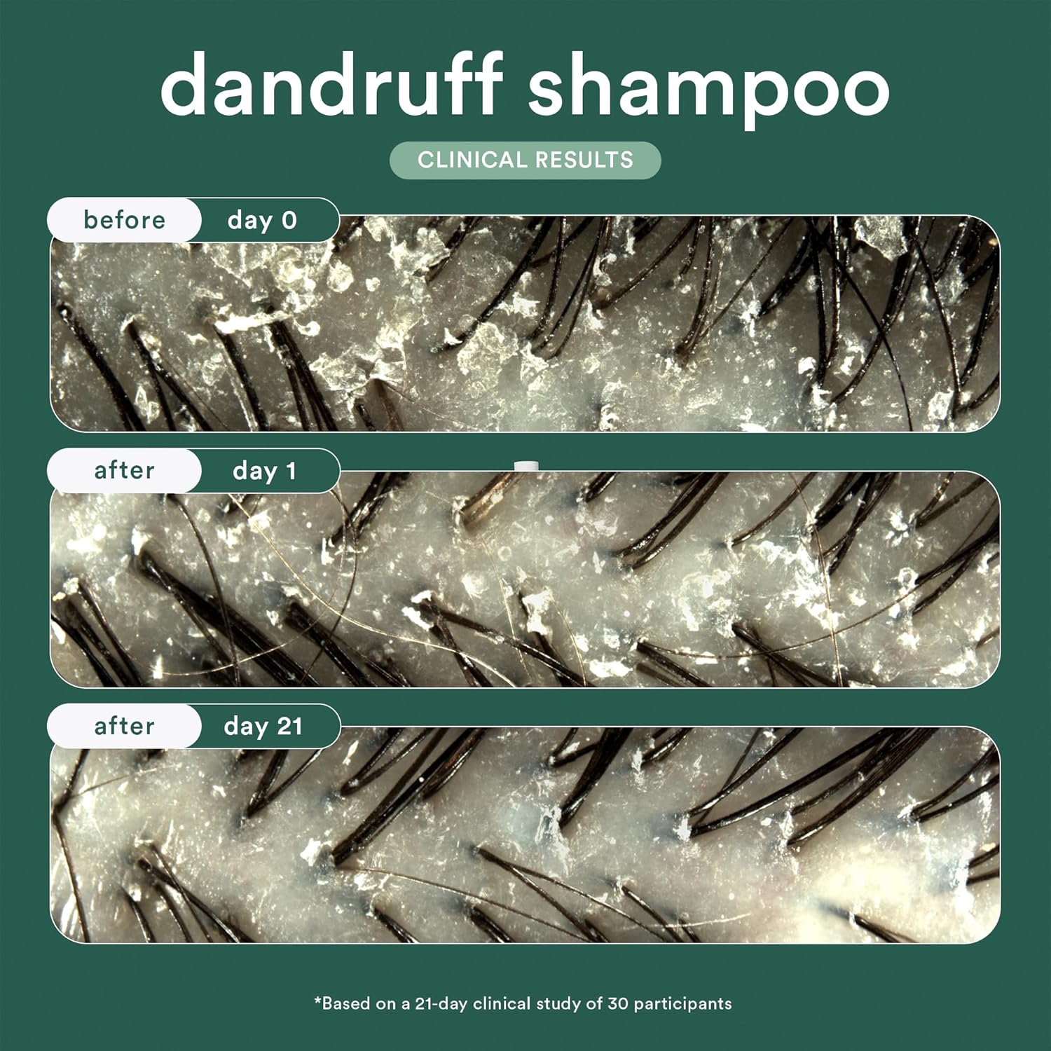 VERB® Dandruff Shampoo - Clinical Strength Relief with 3% Salicylic Acid for Gentle Cleansing