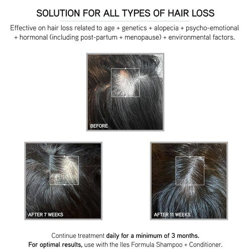 ILES FORMULA Scalp & Hair Rejuvenating Booster - Non-Greasy Serum for Thicker, Stronger Hair - Natural & Fast-Absorbing Procapil Formula