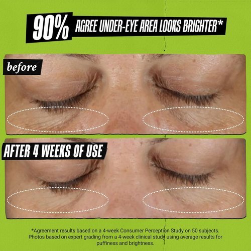 Kiehl's Avocado Eye Treatment - Under Eye Cream for Puffiness & Dark Circles | Caffeine Infused, 99% Natural
