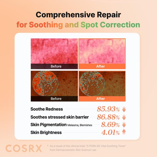 COSRX 5 PDRN B5 Vital Soothing Toner - Korean Toner for Rejuvenating & Soothing Skin with Salmon DNA, Centella, Lactobacillus PDRN & Panthenol, Korean Skin Care (280ml/9.46 fl.oz.)