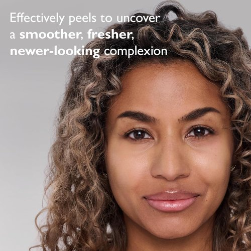 Peter Thomas Roth | FIRMx® Peeling Gel | Gentle Exfoliant for Dull Skin, Pores & Uneven Texture