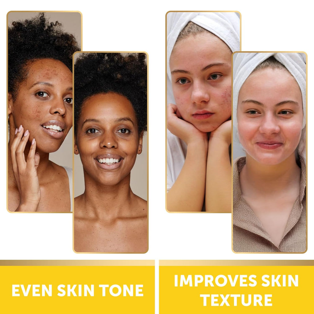 VALITIC Turmeric Kojic Acid Cleansing Pads - Exfoliating Dark Spot Remover with Vitamin C & Retinol - 60 Pads