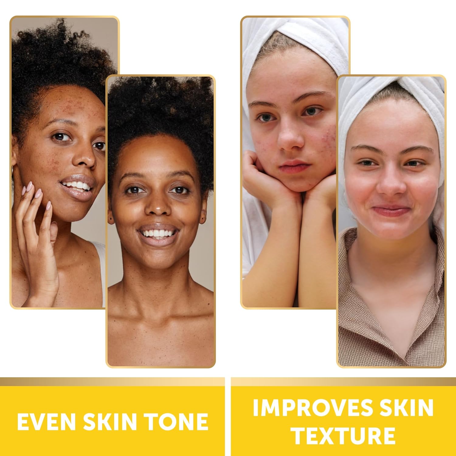 VALITIC Turmeric Kojic Acid Cleansing Pads - Exfoliating Dark Spot Remover with Vitamin C & Retinol - 60 Pads