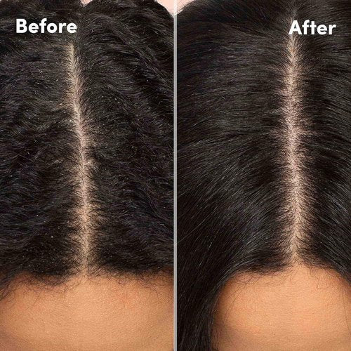 MIZANI Scalp Care Dandruff Shampoo - Deep Cleansing Formula for Curly Hair & Scalp Relief