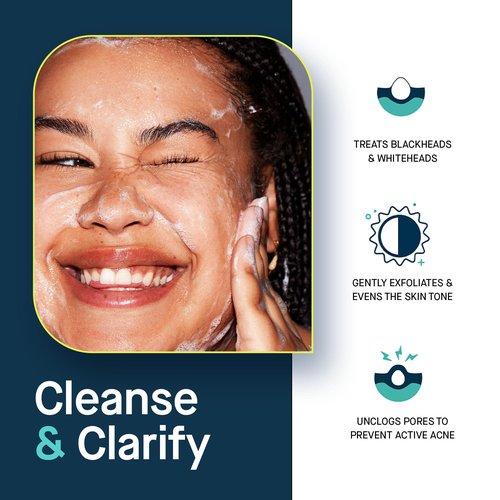 SLMD by Dr. Pimple Popper - Salicylic Acid Cleanser (4 fl oz) Exfoliating Gel Cleanser Face Wash Acne-Prone Skin - Face Wash Helps Reduce the Appearance of Blackheads & Whiteheads