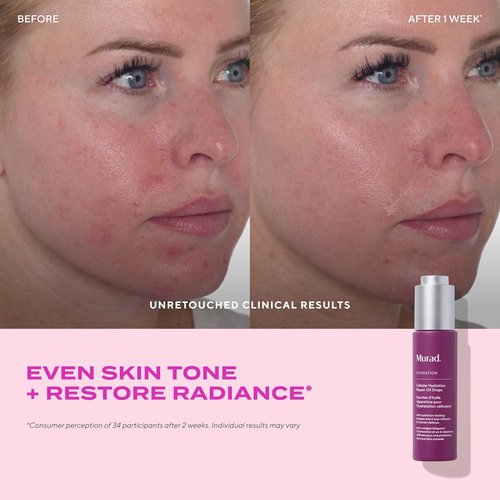 Murad Cellular Hydration Repair Oil Drops - Hydrating Facial Oil for Dry Skin | Boosts Radiance & Smoothness - 1.0 oz