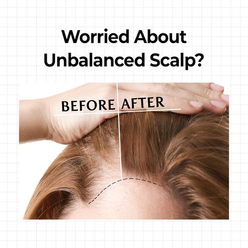 KUNDAL Hair Loss Serum - Caffeine Scalp Tonic & Shampoo for Thicker Hair | White Musk Scent