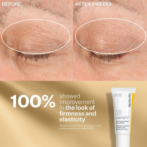 StriVectin Peptight Face Lift Serum - Tightening & Brightening Peptides for Youthful Skin