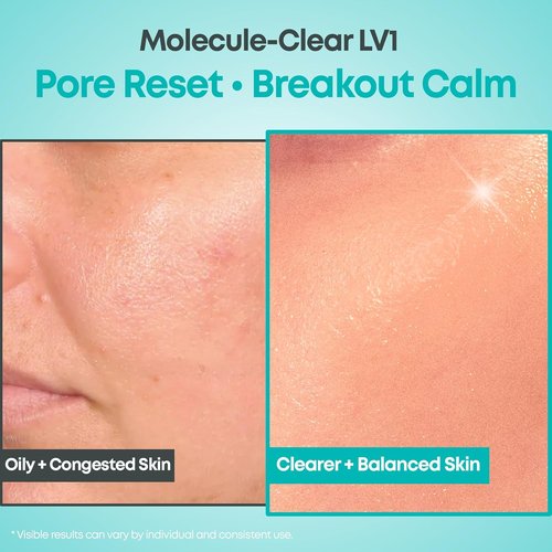 NINELESS Salicylic Acid Serum - Deep Pore Exfoliation for Oily Acne-Prone Skin | Hydrating & Soothing, 1.01 fl oz