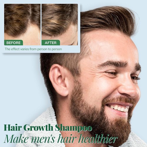 Regine Switzerland Hair Growth Shampoo - Rosemary & Biotin Formula for Thicker Hair | 12.8 Fl Oz, Sulfate-Free