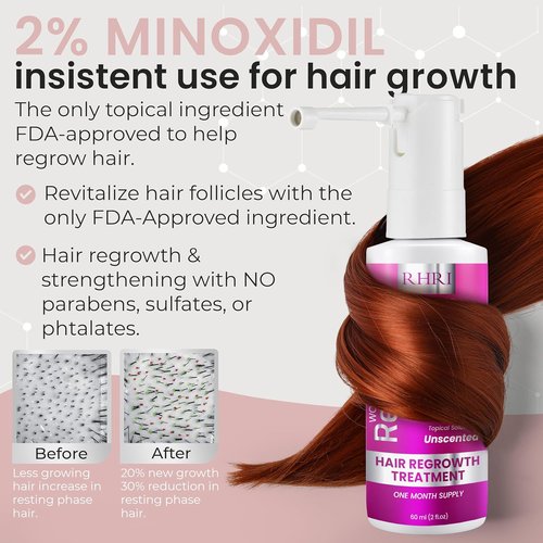 Regine Switzerland 2% Minoxidil Hair Regrowth Spray - Clinically Proven Solution for Thicker, Fuller Hair - 60 ml