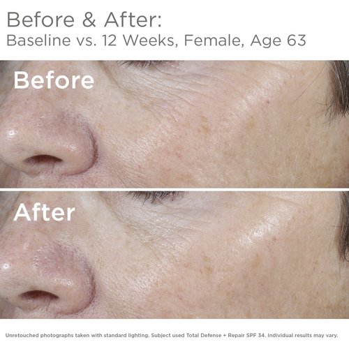 SkinMedica Total Defense + Repair SPF 34 | Advanced Sunscreen for Face Protection