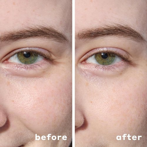 Mario Badescu Hydrogel Under Eye Patches - Hydrating Eye Masks for Dark Circles & Puffiness | 30 Pairs with Hyaluronic Acid & Niacinamide