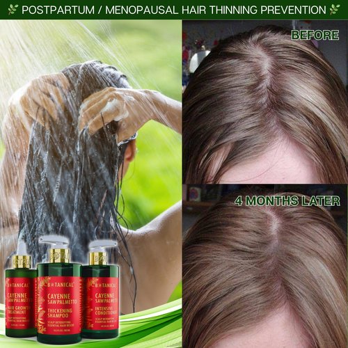 Botanical Hair Growth Cayenne Shampoo with Saw Palmetto for Hair Loss and Hair Thinning Prevention Scalp Detoxifying Natural Thickening Shampoo Regrowth Products For Women & Men 10.2 Fl Oz