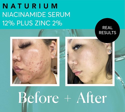 Naturium Niacinamide Face Serum 12% - Anti-Aging & Pore Minimizer with Zinc, 1 oz | Vegan & Cruelty-Free