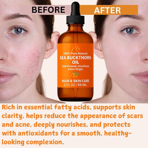 Pomberries Sea Buckthorn Oil – 100% Pure Cold-Pressed from Fruit & Seed – Sea Buckthorn Seed Oil for Face, Hair, Skin & Nails – Supports Radiant, Youthful-Looking Skin – Amber Glass Bottle 2 fl oz