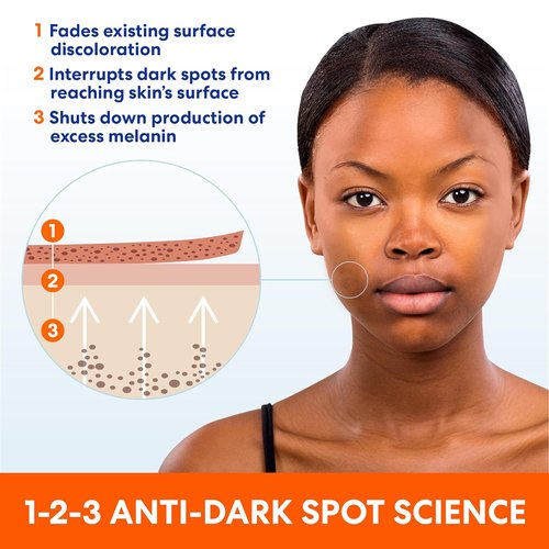 Palmer's Skin Success Anti-Dark Spot Fade Cream - Vitamin E & Niacinamide, 2.7 Oz for All Skin Types