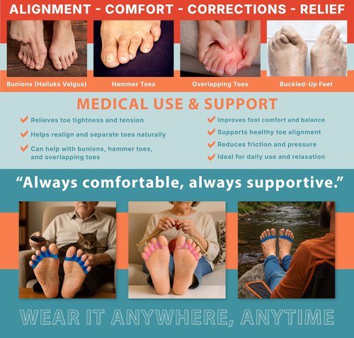 TEGA Toe Separators & Spacers for Men and Women - Silicone Toe Straightener for Bunion Correction, Plantar Fasciitis & Hammer Toe Relief - Restore Natural Foot Shape (Small/Medium)